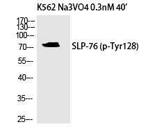 SLP-76 (Phospho-Tyr128) Polyclonal Antibody