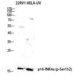 p16 (Phospho-Ser152) Polyclonal Antibody