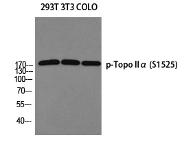 Topo IIα (Phospho-Ser1525) Polyclonal Antibody