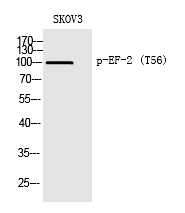 EF-2 (Phospho-Thr56) Polyclonal Antibody