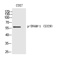 DNAM-1 (Phospho-Ser329) Polyclonal Antibody