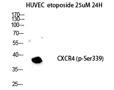 Fusin (Phospho-Ser339) Polyclonal Antibody