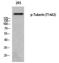 Tuberin (Phospho-Thr1462) Polyclonal Antibody