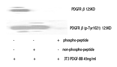 PDGFR-β (Phospho-Tyr1021) Polyclonal Antibody