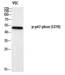 p47-phox (Phospho-Ser370) Polyclonal Antibody