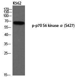 p70 S6 kinase α (Phospho-Ser427) Polyclonal Antibody