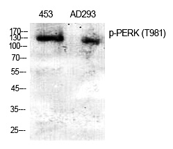 PERK (Phospho-Thr982) Polyclonal Antibody