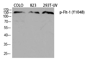 Flt-1 (Phospho-Tyr1048) Polyclonal Antibody