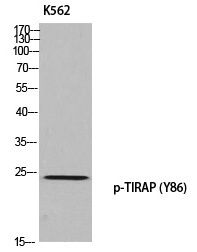 TIRAP (Phospho-Tyr86) Polyclonal Antibody