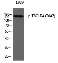 TBC1D4 (Phospho-Thr642) Polyclonal Antibody