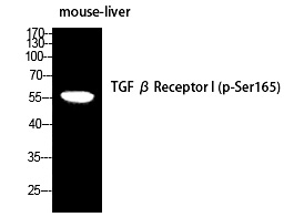 TGFβ RI (Phospho-Ser165) Polyclonal Antibody