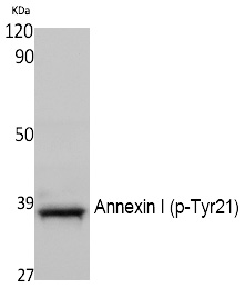 Annexin I (Phospho-Tyr21) Polyclonal Antibody