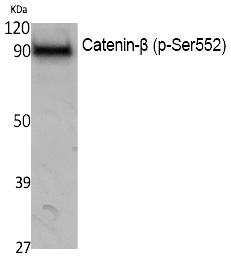 Catenin-β (Phospho-Ser552) Polyclonal Antibody