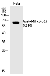 NFκB-p65 (Acetyl-Lys310) Polyclonal Antibody