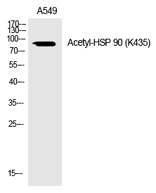 HSP 90 (Acetyl-Lys435) Polyclonal Antibody