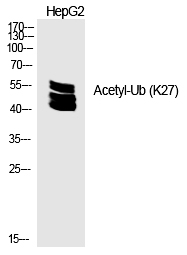 Ub (Acetyl-Lys27) Polyclonal Antibody