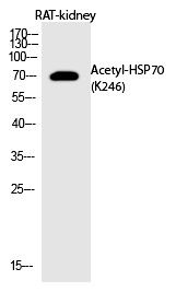 HSP70 (Acetyl-Lys246) Polyclonal Antibody