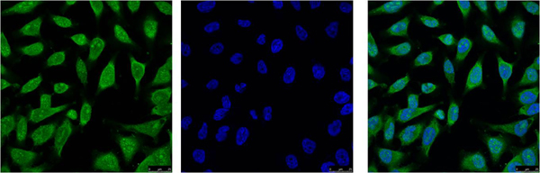 HSP70 Monoclonal Antibody