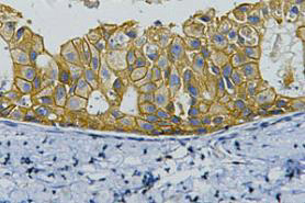 HER2 Monoclonal Antibody