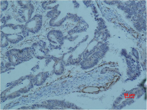 Survivin Monoclonal Antibody