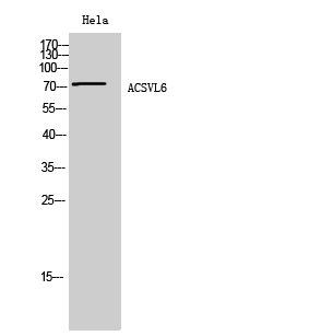 ACSVL6 Polyclonal Antibody