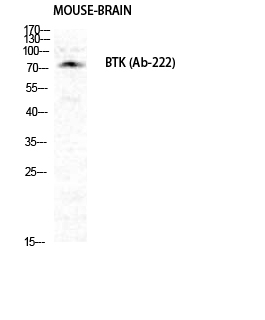 Btk Polyclonal Antibody