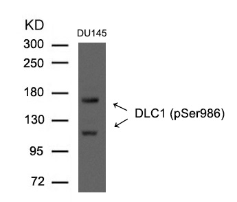 DLC1 (Phospho-Ser986) Antibody