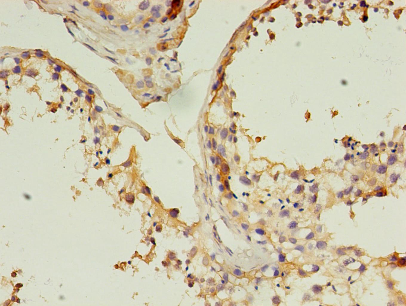 CD14 Monoclonal Antibody