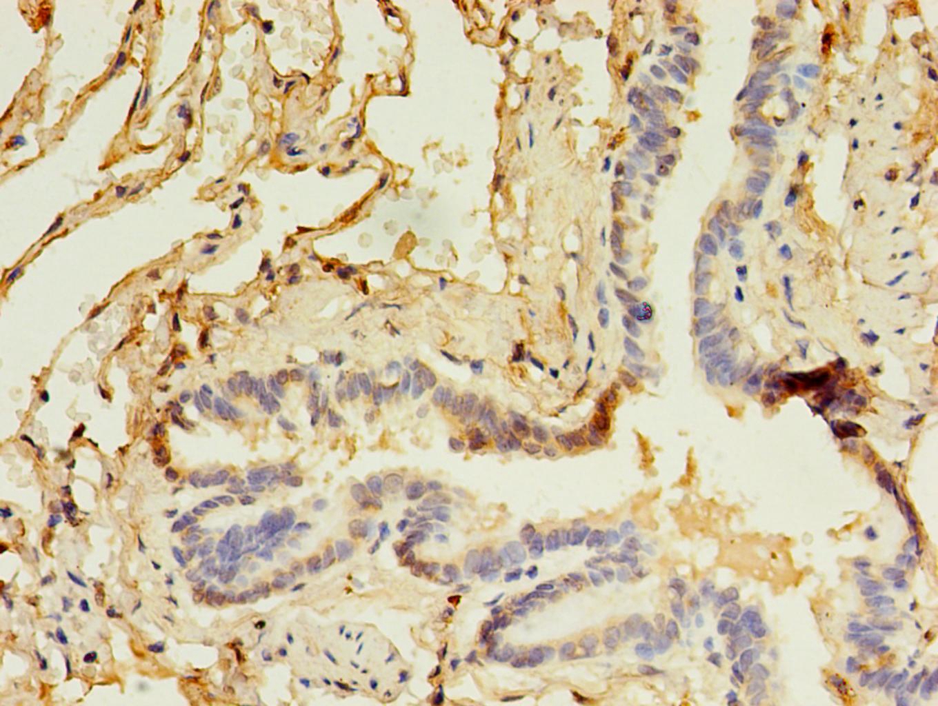 CD14 Monoclonal Antibody