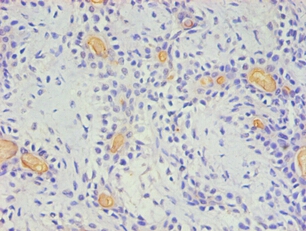 CD59 Monoclonal Antibody