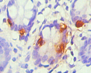 chromogranin A Monoclonal Antibody