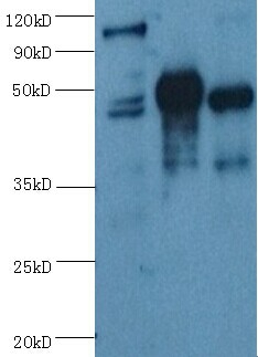 ENO2/NSE Monoclonal Antibody