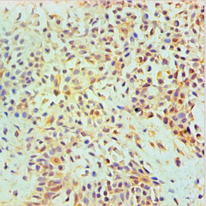 ANXA2 Monoclonal Antibody