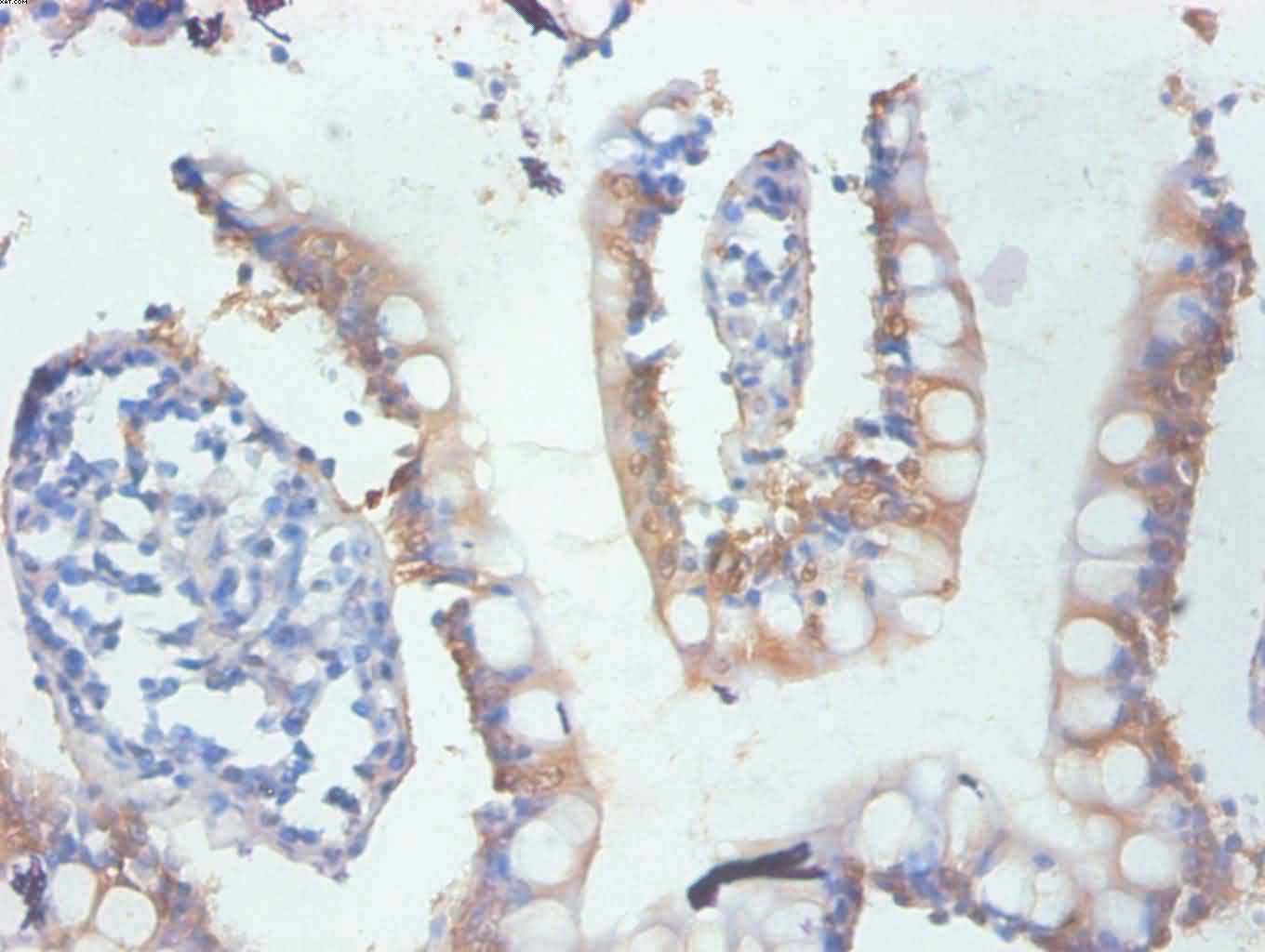 GAL-3 Monoclonal Antibody