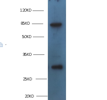 TGM2 Monoclonal Antibody