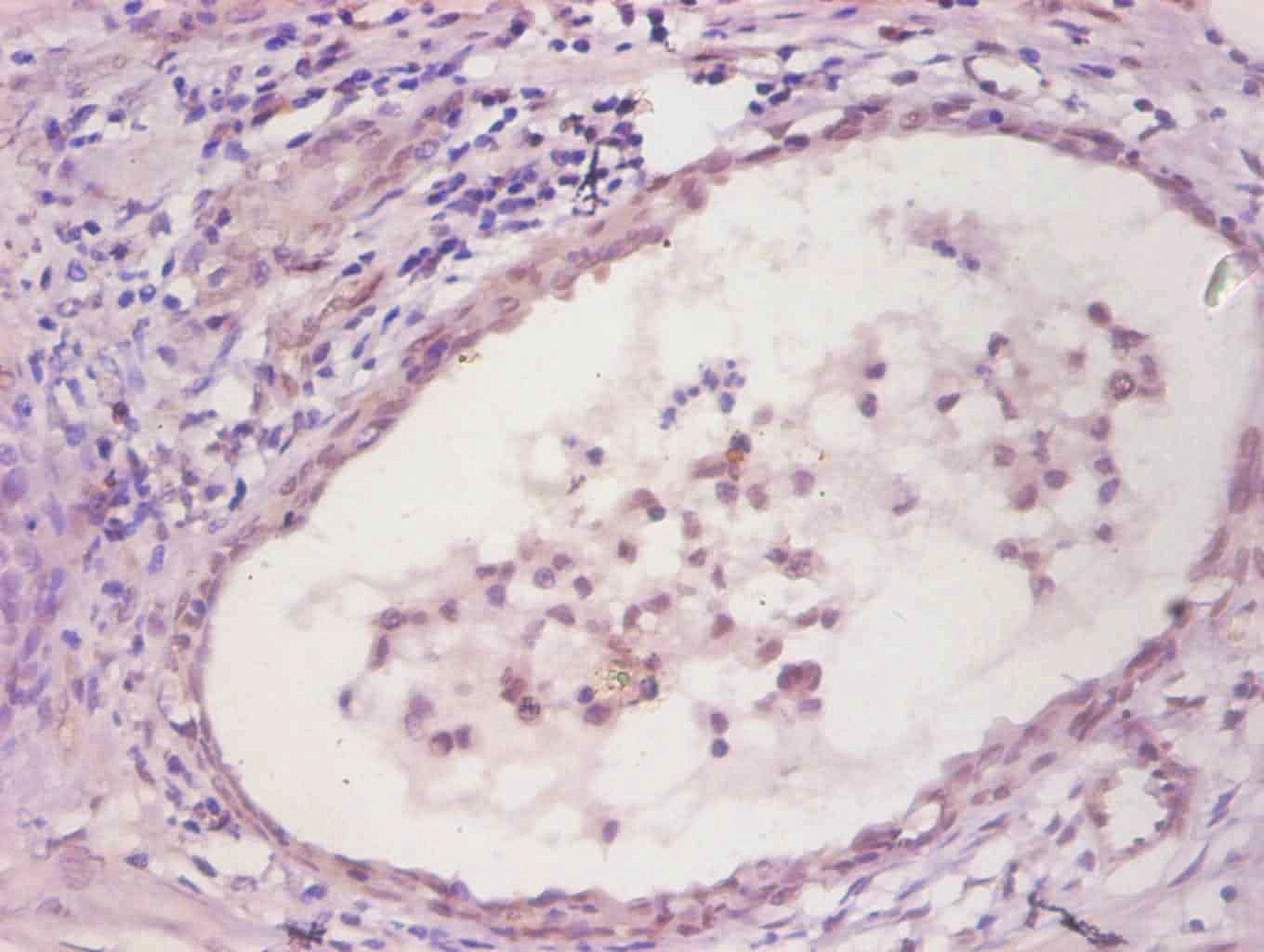 IL6 Monoclonal Antibody