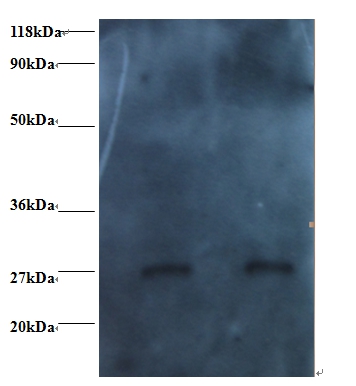 RBP4 Monoclonal Antibody