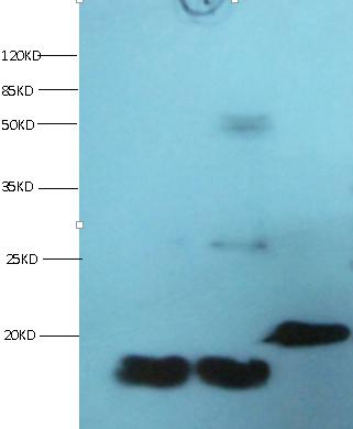 FABP3 Monoclonal Antibody