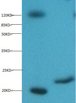 Myoglobin Monoclonal Antibody