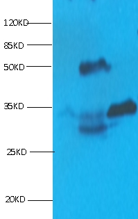 Cardiac Troponin I Monoclonal Antibody