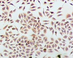 Podocalyxin Monoclonal Antibody