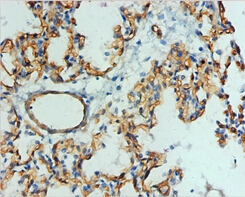 Podocalyxin Monoclonal Antibody