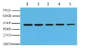 β-actin Monoclonal Antibody(5B7)