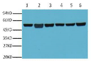 β-Tubulin Monoclonal Antibody(5G3)