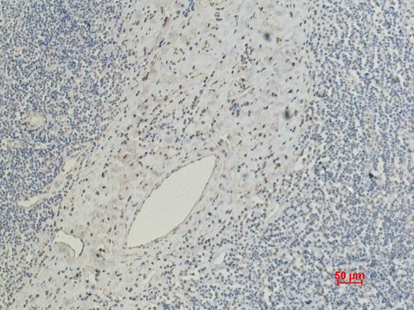 CD5 Monoclonal Antibody(10G8)