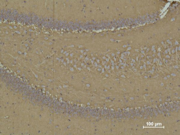 CD15 Monoclonal Antibody(Q89)