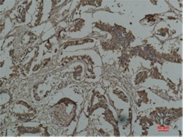 HSP27 Monoclonal antibody(Mix-mA)