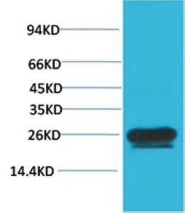 HSP27 Monoclonal antibody(Mix-mA)