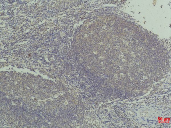 TNF α Monoclonal antibody(Q36)