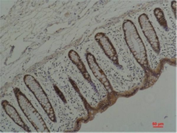 HSP90 α Monoclonal antibody(1F6)